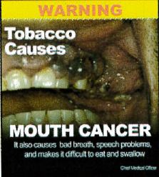 Jamaica 2013 Health Effect mouth - teeth, gums, gross, smokeless warning (back)